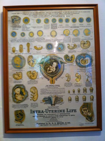 Frida Kahlo's design tracking interuterine life